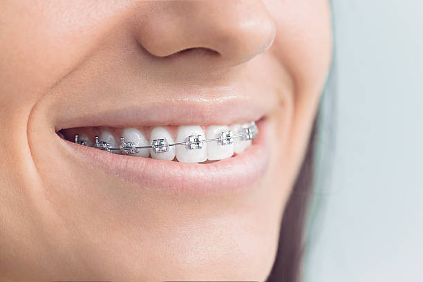 Best Traditional Braces  in Cross Plains, TX